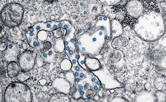 Novel Coronavirus (COVID-19)