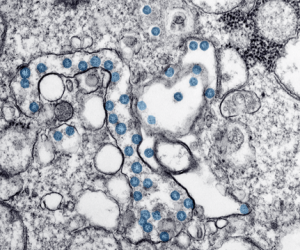 Novel Coronavirus (COVID-19)